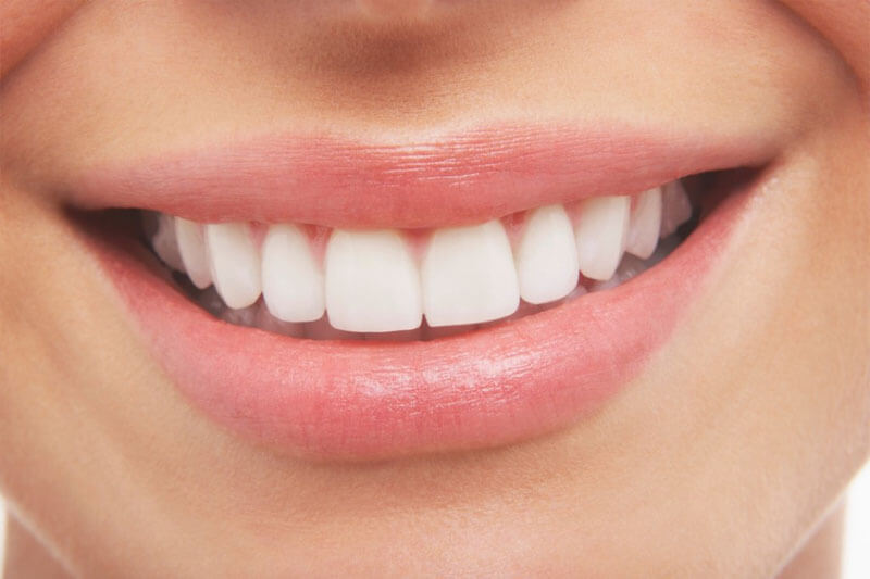 Close-up picture of a smiling woman with perfect teeth, happy with her new dentures she had at Premier Holistic Dental in Costa Rica.