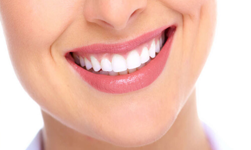 Close-up picture of a smiling happy woman with perfect teeth, showing her happiness with her All-on-Four implant-supported denture  she had made at Premier Holistic Dental in beautiful Costa Rica.