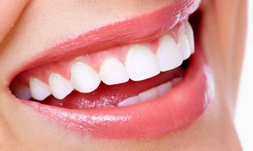 Close-up picture of a smiling happy woman with perfect teeth, showing her happiness with her All-on-Two implant-supported denture  she had made at Premier Holistic Dental in beautiful Costa Rica.