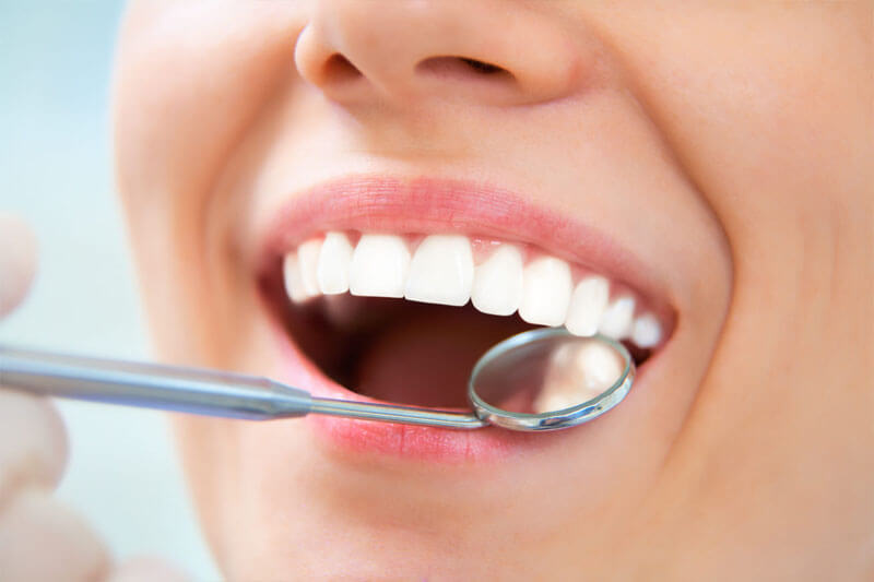 Close-up picture of a smiling woman showing perfect teeth and happy with the bone grafts procedure she had at Premier Holistic Dental in Costa Rica.