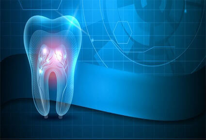 Illustration of a tooth being treated with a laser, showing how a laser treatment is done in Costa Rica.