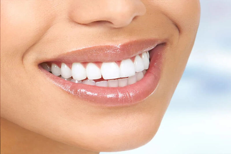 Close-up picture of a smiling woman, happy with the Holistic dental implants she received from Premier Holistic Dental in Costa Rica.