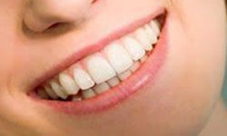 Close-up picture of a smiling woman with perfect white teeth, happy with her new dentures done at Premier Holistic Dental in beautiful Costa Rica.