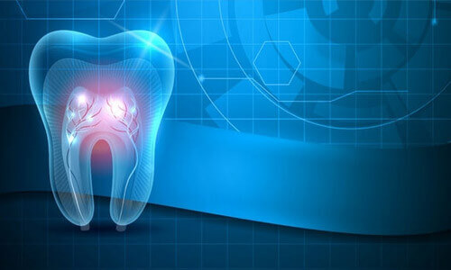 Illustration of a tooth showing how a laser is used in dental work. at Premier Holistic Dental in beautiful Costa Rica.  The picture shows a blue tinted tooth against a blue background.