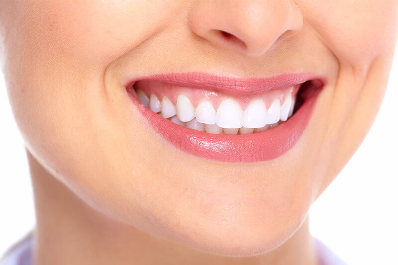 Close-up picture of a smiling woman, happy with her implant-supported dentures she had at Premier Holistic Dental in Costa Rica.