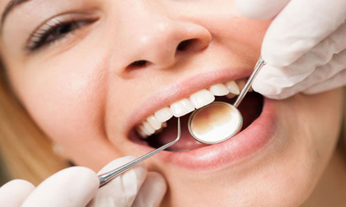 Close- picture of a happy woman with perfect white teet in a dental chair having a dental inlay/onlay procedure at Premier Holistic Dental in beautiful Costa Rica.