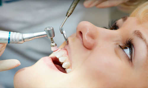 Close-up picture of a smiling woman showing her perfect teeth and happy with the oral surgery procedure she had done at Premier Holistic Dental in beautiful Costa Rica.  The picture shows dental tools above her upper teeth showing how the oral surgery is done.