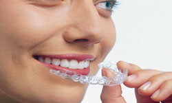 Close-up picture of a smiling woman with perfect teeth having an Orthodontics procedure with an invisible brace at Premier Holistic Dental in beautiful Costa Rica.