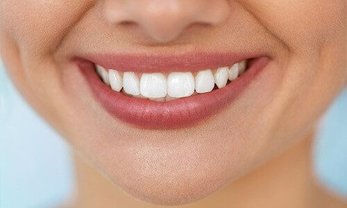 Close-up picture of a smiling young woman with perfect teeth happy with her Holistic ozone therapy treatment at Premier Holistic Dental in beautiful Costa Rica.