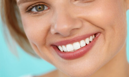 Close-up picture of a smiling young woman with short brown hair and perfect teeth, happy with her Holistic safe mercury removal at Premier Holistic Dental in beautiful Costa Rica.