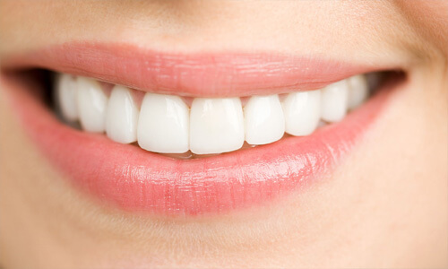 Close-up picture of a smiling woman with perfect white teeth showing her happiness with the dental veneers she received at Premier Holistic Dental in beautiful Costa Rica.